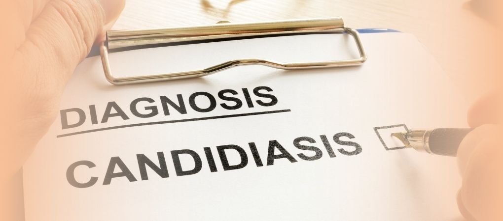 Candidiasis - Osteopedia - il portale mondiale dell'osteopatia